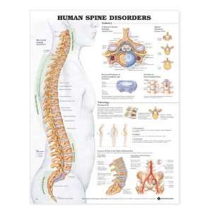  Human Spine Disorders Anatomical Chart 20 x 26 (Catalog 