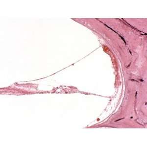  Cochlear Canal and the Organ of Corti in the Ear 