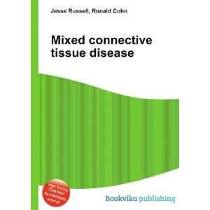  Mixed connective tissue disease Ronald Cohn Jesse Russell 